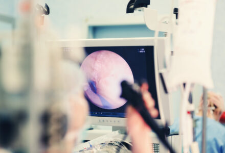 Teil magen darm spiegelung behandlung medicum bad aibling